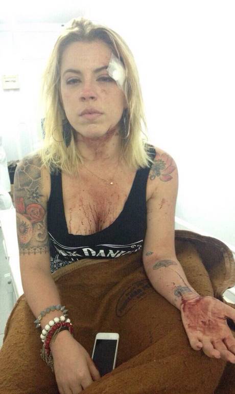 Empresário que espancou buldogues é acusado de agredir a ex-noiva