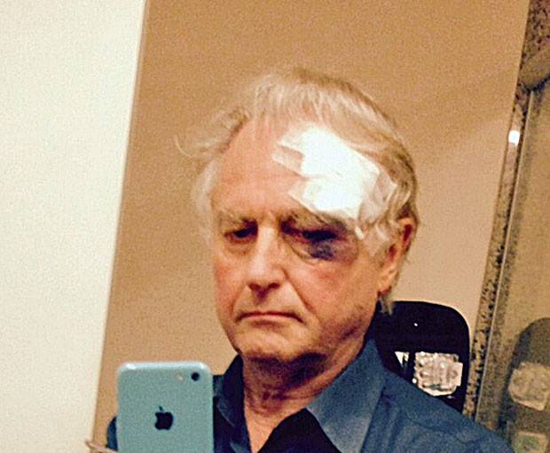 Richard Dawkins cai em aeroporto e é levado ao hospital
