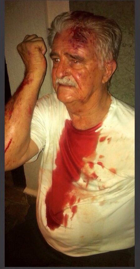 Idoso de 82 anos é agredido por universitário