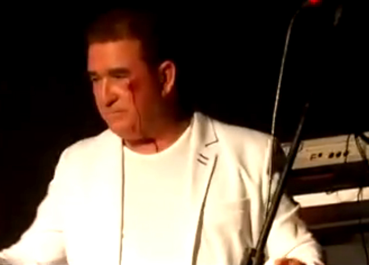 Amado Batista leva uma pedrada de gelo no rosto e abandona show