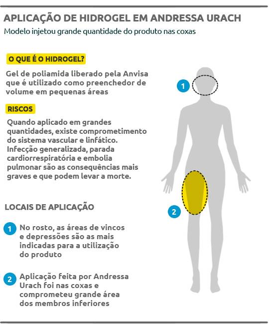 Fotos da perna de Andressa Urach repercutem em sites internacionais