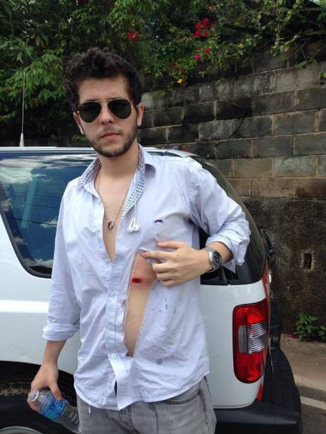 André Zanardo, do grupo Advogados Ativistas: atingido por bala de borracha André Zanardo, do grupo Advogados Ativistas: atingido por bala de borracha