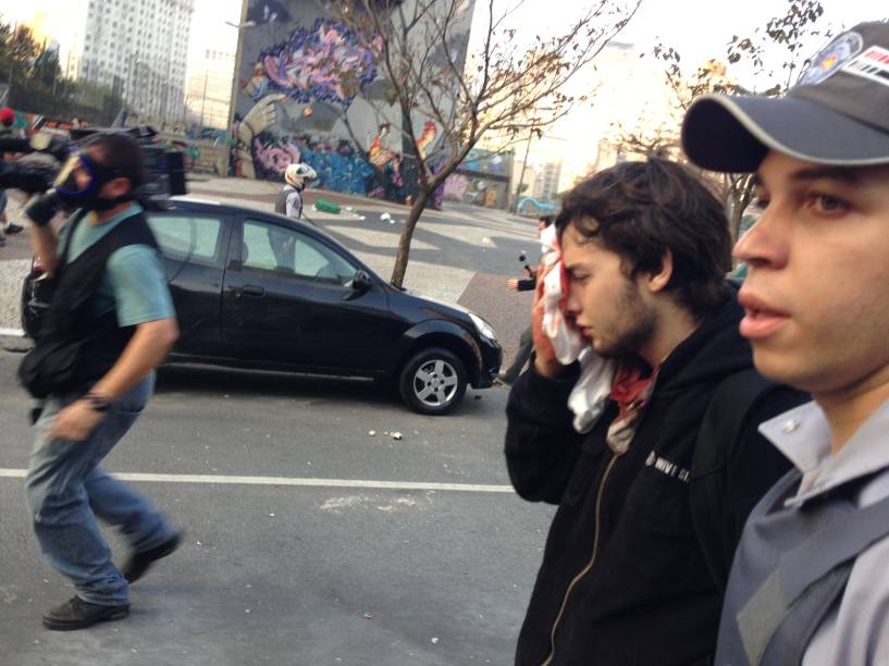 Manifestante foi ferido no olho durante o confronto