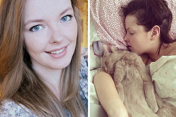 Vítima de uma Síndrome rara, jovem de 22 anos já dormiu por seis meses após tirar uma soneca no sofá