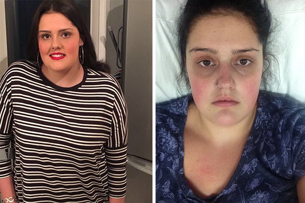 Estudante de 20 anos de idade quase morre após se esquecer de substituir o absorvente interno