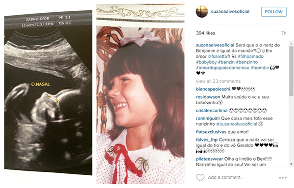 Suzana Alves, a Tiazinha, faz comparação curiosa usando foto do ultrassom do filho