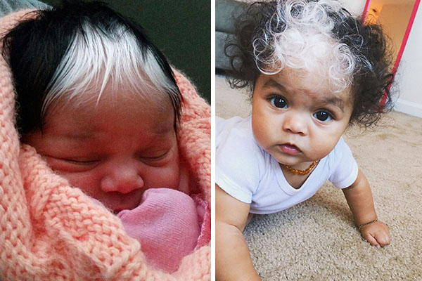 Bebê chama a atenção ao nascer com a mesma inusitada marca de nascença de sua mãe, avó e bisavó