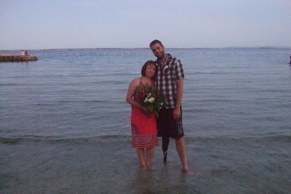 Homem transforma osso de sua perna em anel de noivado da esposa