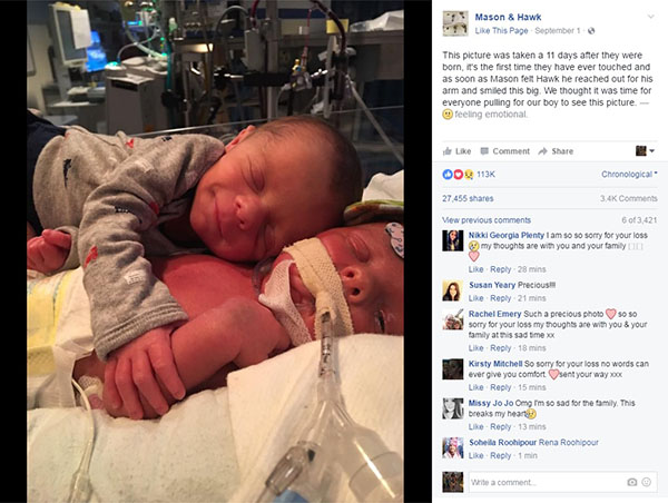 Gêmeos se reencontram onze dias após nascimento e registro emociona milhares de pessoas