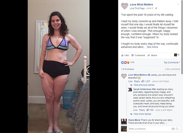 A foto desta jovem usando biquíni está fazendo sucesso no Facebook por um motivo inspirador