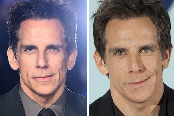 Em programa de rádio, o ator e diretor Ben Stiller revelou batalha contra o câncer de próstata
