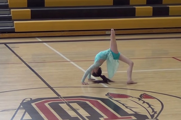 Garotinha faz coreografia inspiradora meses após ter sua perna amputada; assista