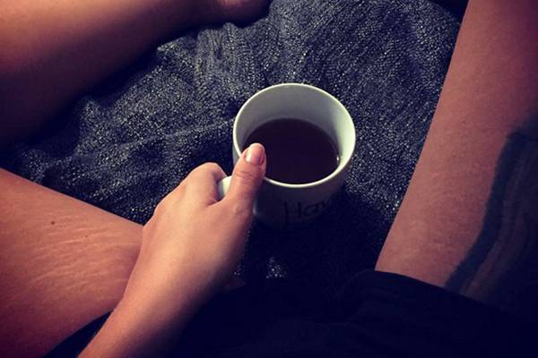 Mulheres estão tirando fotos de suas estrias e celulites por uma boa causa