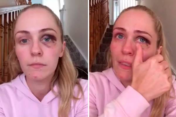 Blogueira fitness vítima de violência doméstica faz desabafo emocionante após terminar relacionamento