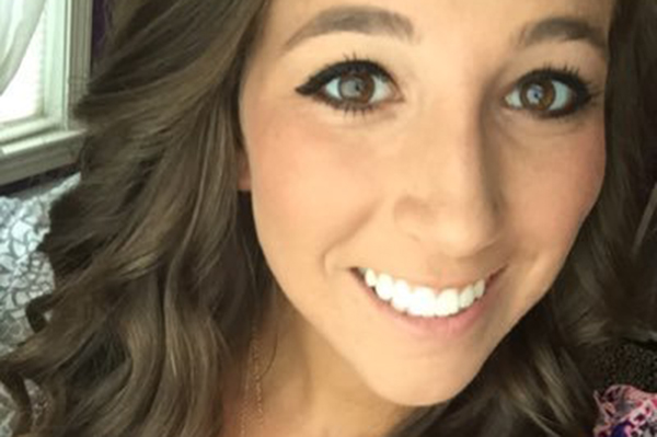 Esta jovem ficou irreconhecível após sofrer com uma severa reação alérgica nas olhos