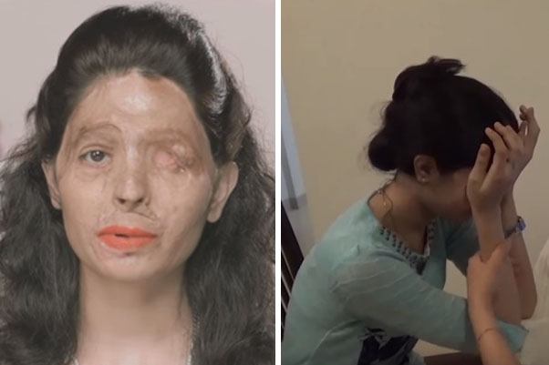 Em vídeo, sobrevivente de ataque com ácido recebe notícia de que participará da Semana de Moda de NY