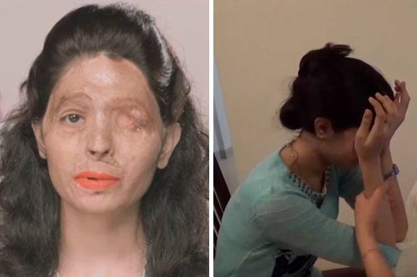Em vídeo, sobrevivente de ataque com ácido recebe notícia de que participará da Semana de Moda de NY