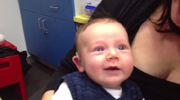 Vídeo mostra a reação de bebê com aparelho auditivo ouvindo pela primeira vez