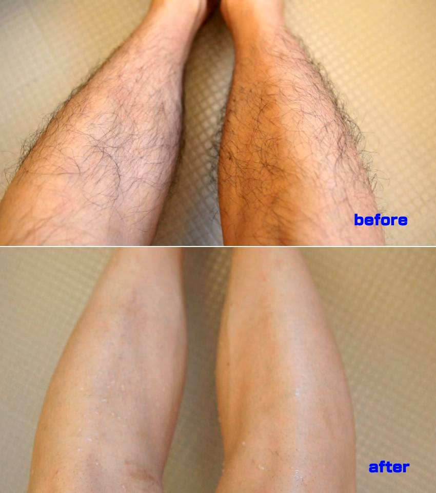 Espuma depilatória japonesa promete remover pelos com apenas um enxague