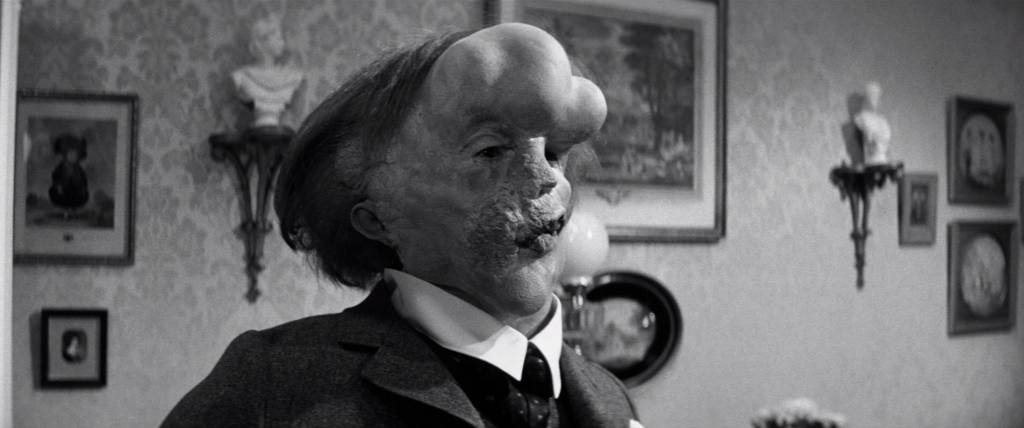 O Homem Elefante: drama dirigido por David Lynch O Homem Elefante: drama dirigido por David Lynch