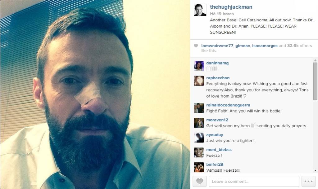 hugh-jackman-wolwerine-c%c3%a2ncer-de-pele-instagram2