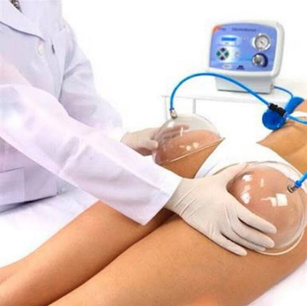 Polêmica, técnica de ‘sugar o bumbum com ventosas’ não promove efeito a longo prazo