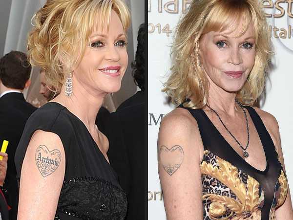 Melanie Griffith apaga a tatuagem com o nome de Antonio Banderas. Veja como ficou!