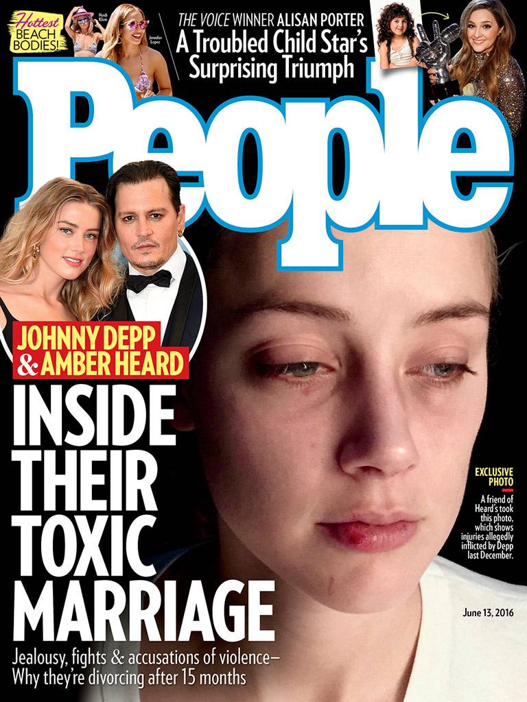 Novas fotos de Amber Heard com o rosto machucado reacendem acusações contra Johnny Depp