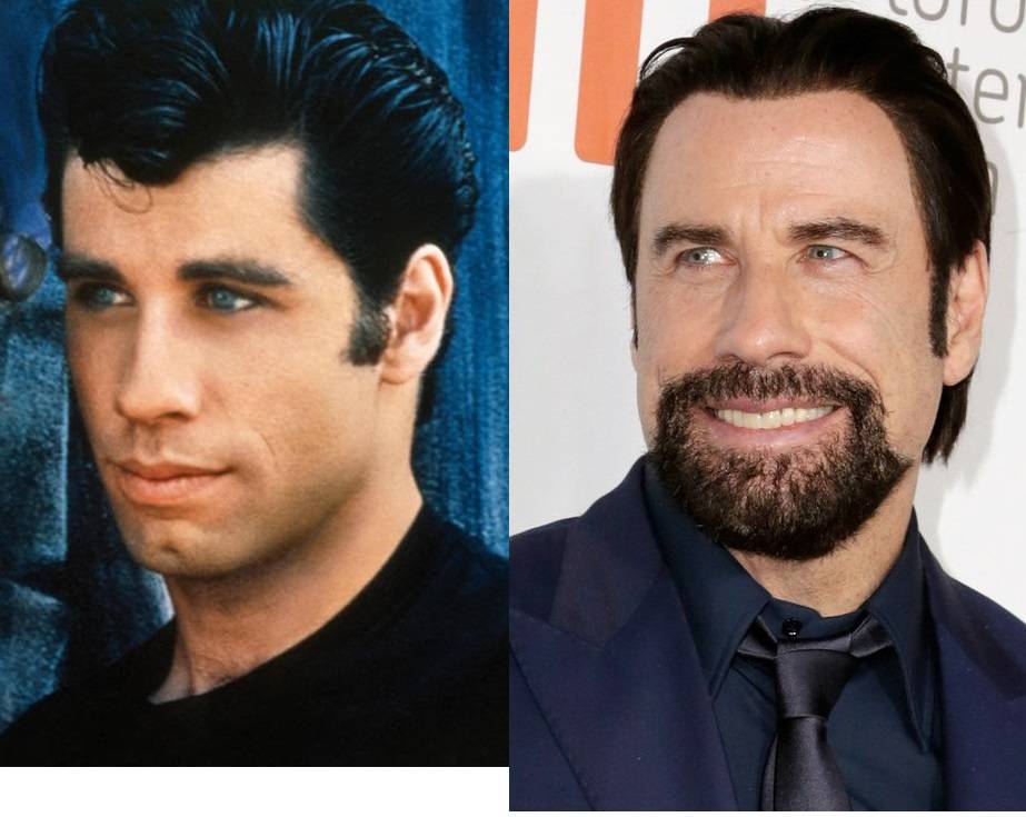 Grease: veja como estão os atores do musical de 1978