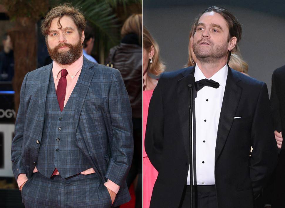 Zach Galifianakis emagreceu mais ainda e ficou irreconhecível. Veja a foto