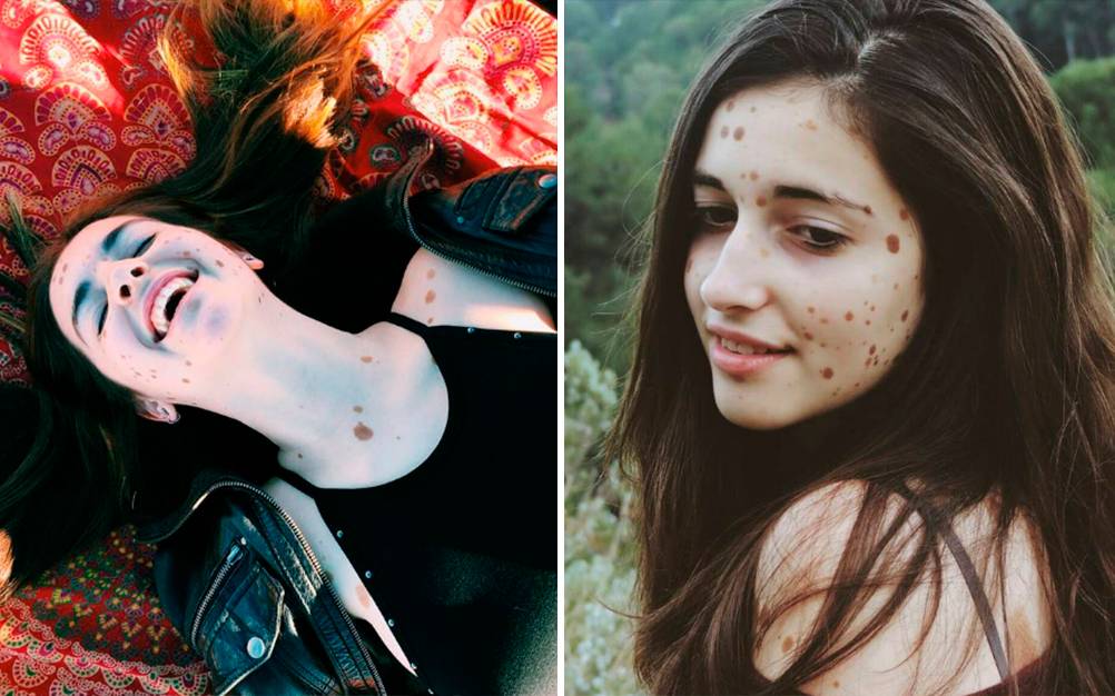 Após sofrer no colégio, jovem emplaca carreira como modelo