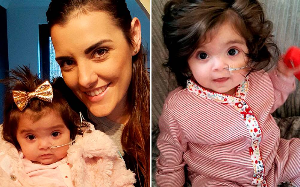 Bebê nasce com muito cabelo e é confundida com boneca