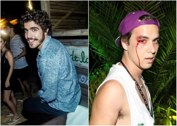 Fotógrafo agredido por Caio Castro pede 100 000 reais