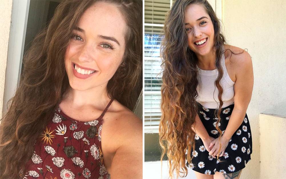 Mulher perde 45 quilos, exibe celulite e responde críticas