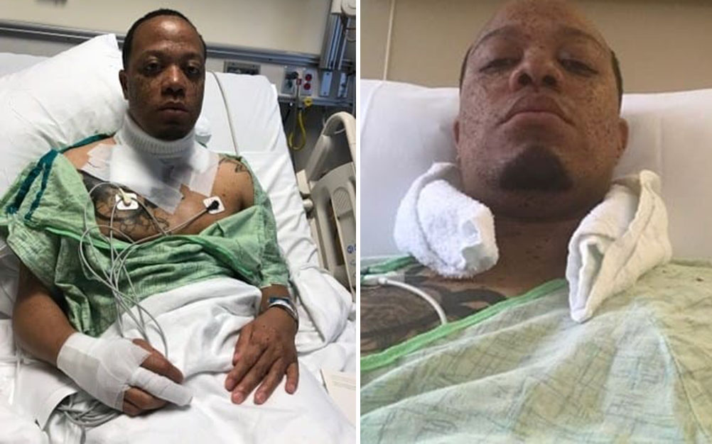 Após dormir com celular na tomada, ele “tem sorte de estar vivo”