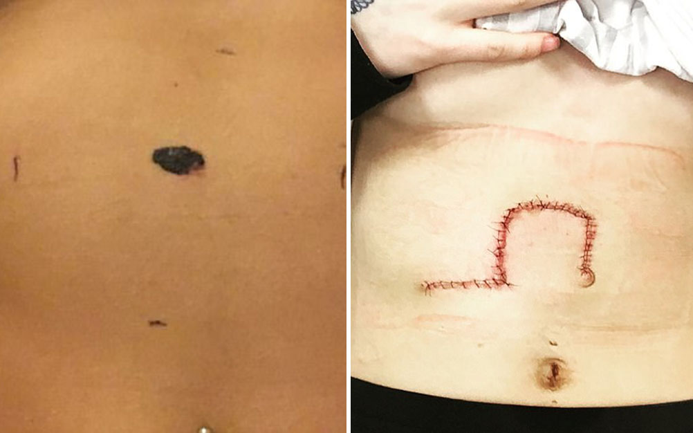 selfie-salva-vida-03