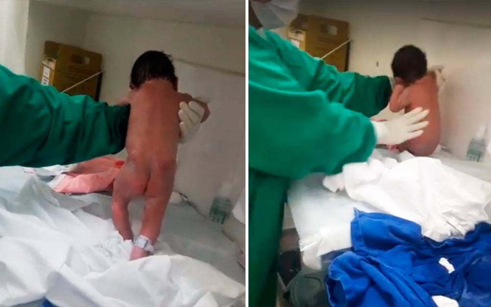 Por que este recém-nascido parece “caminhar” na maternidade?