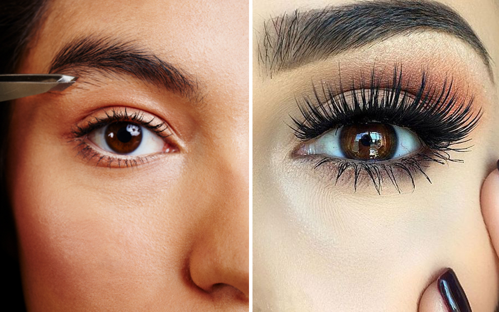 Jovem desabafa após tratamento para sobrancelhas dar errado