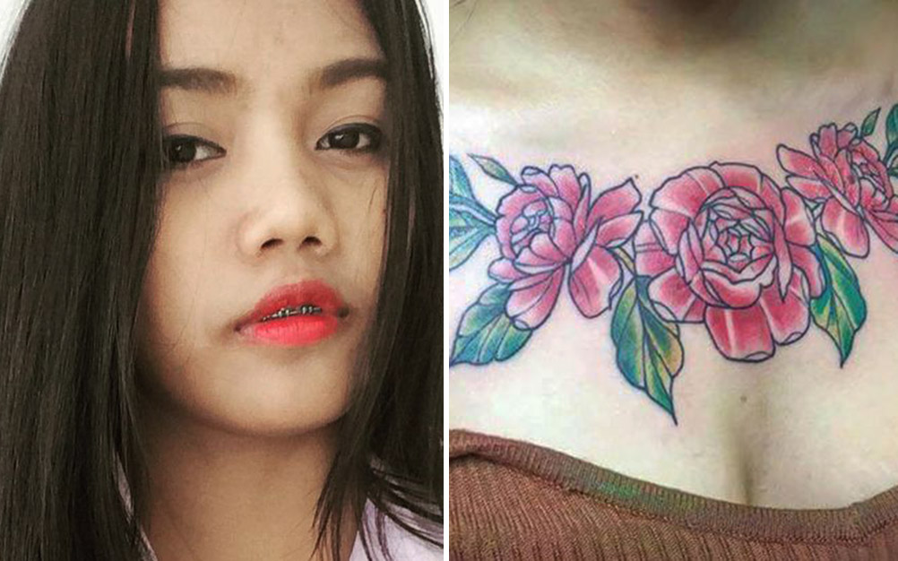 Jovem compartilha fotos de “remoção de tatuagem que deu errado”