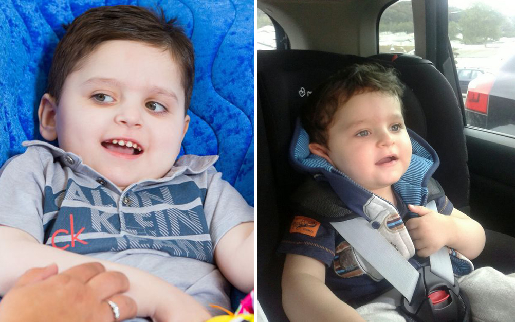 menino-desaprende-sorrir-sindrome-02