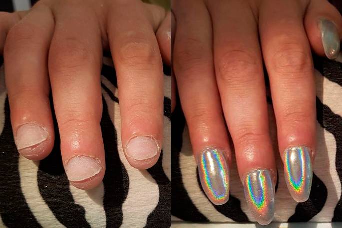 Alongamento mal feito deixa unhas de cliente deformadas