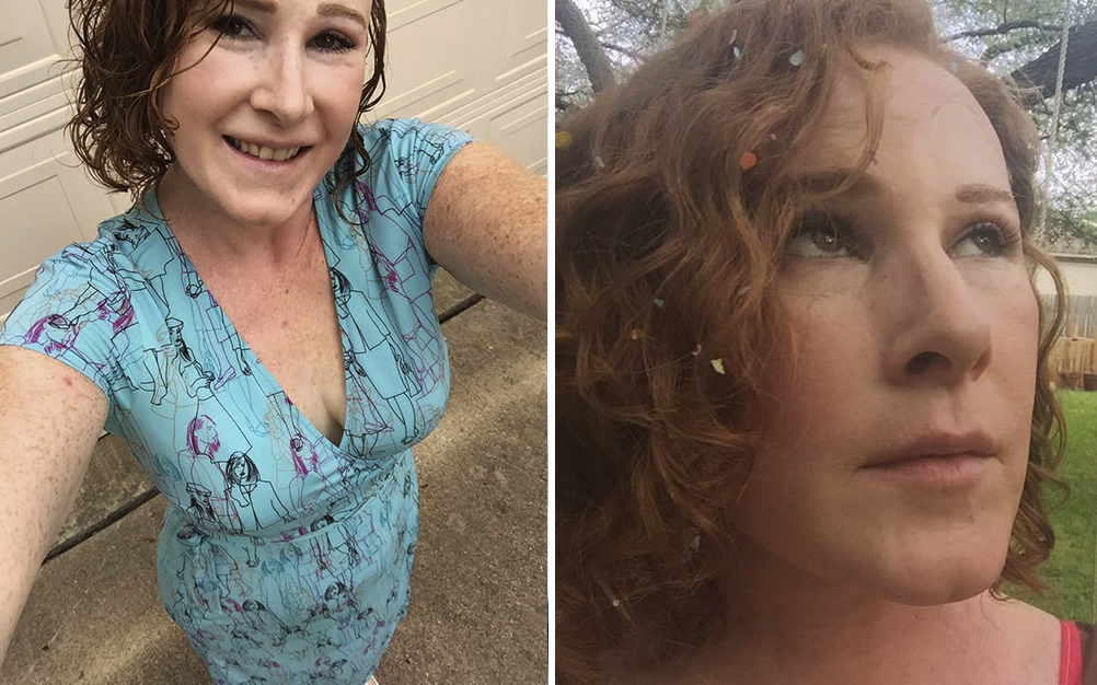 Mulher revela tratamento contra câncer em fotos no Facebook