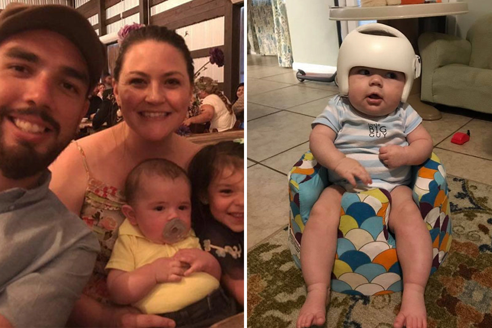 bebe-capacete-familia-apoio-04