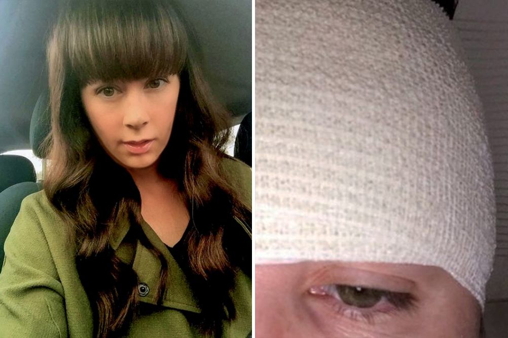 Após procedimento estético, mulher quer alertar outros clientes