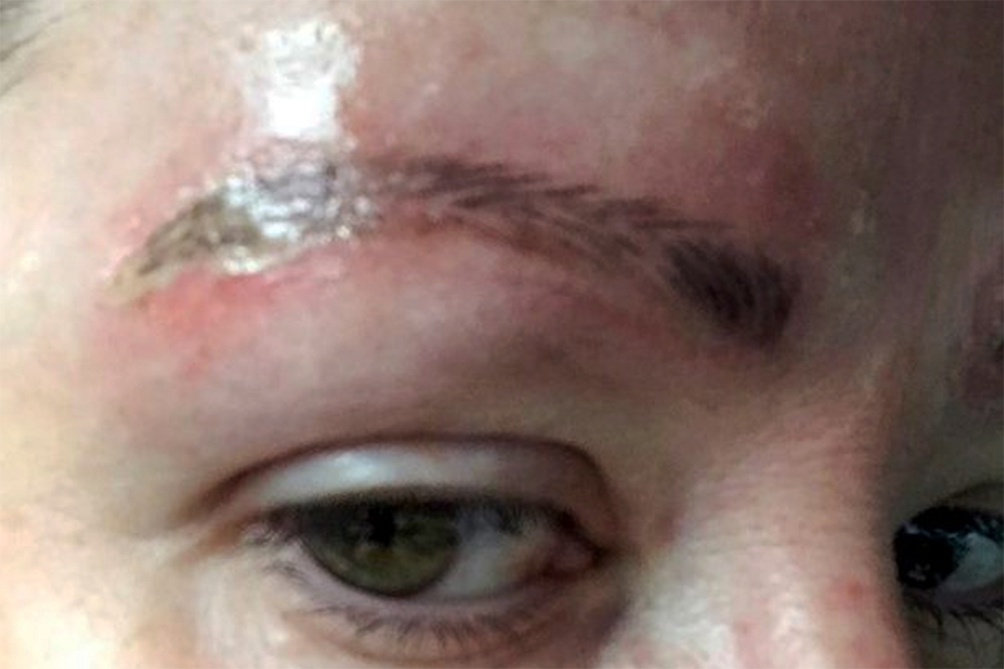 mae-procedimento-estetico-04