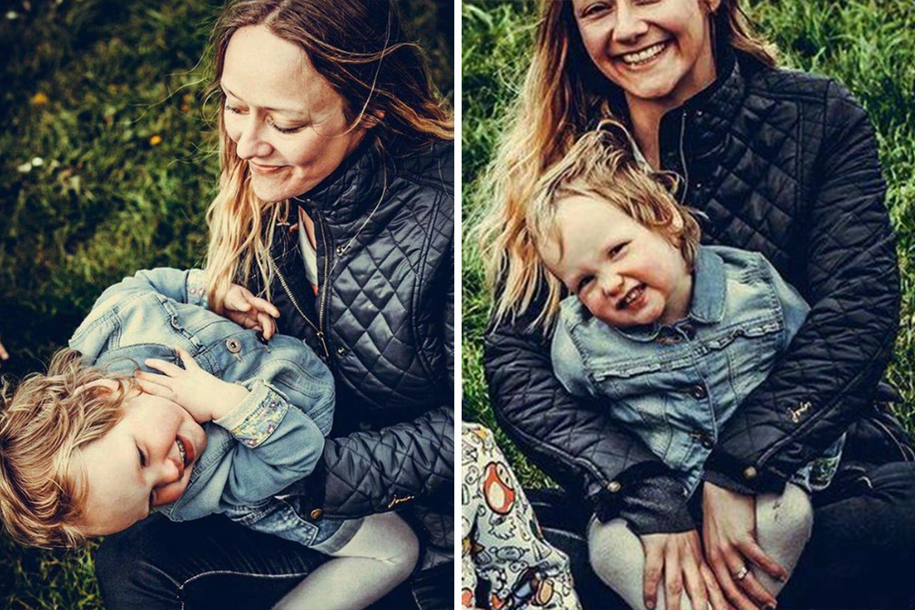 Mãe toma medida radical após filha arrancar o próprio cabelo