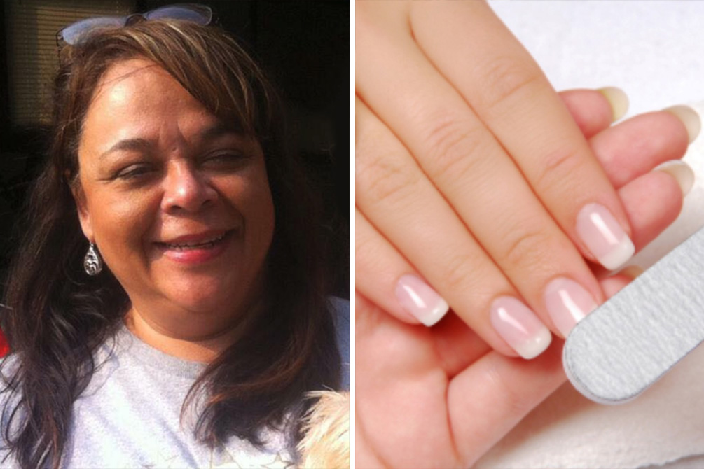 Mulher faz alerta sobre câncer de pele em publicação no Facebook