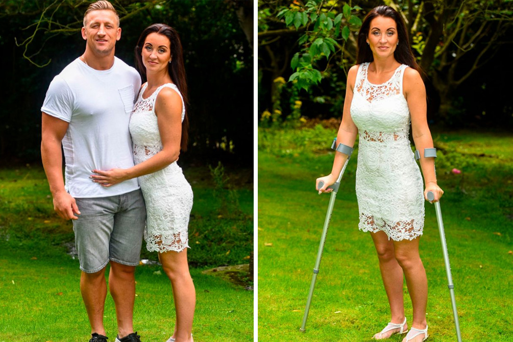 mulher-derrame-medular-03