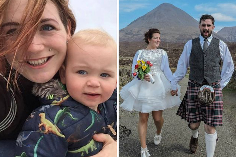 Após ultrassom, mulher descobre que gravidez é um tumor