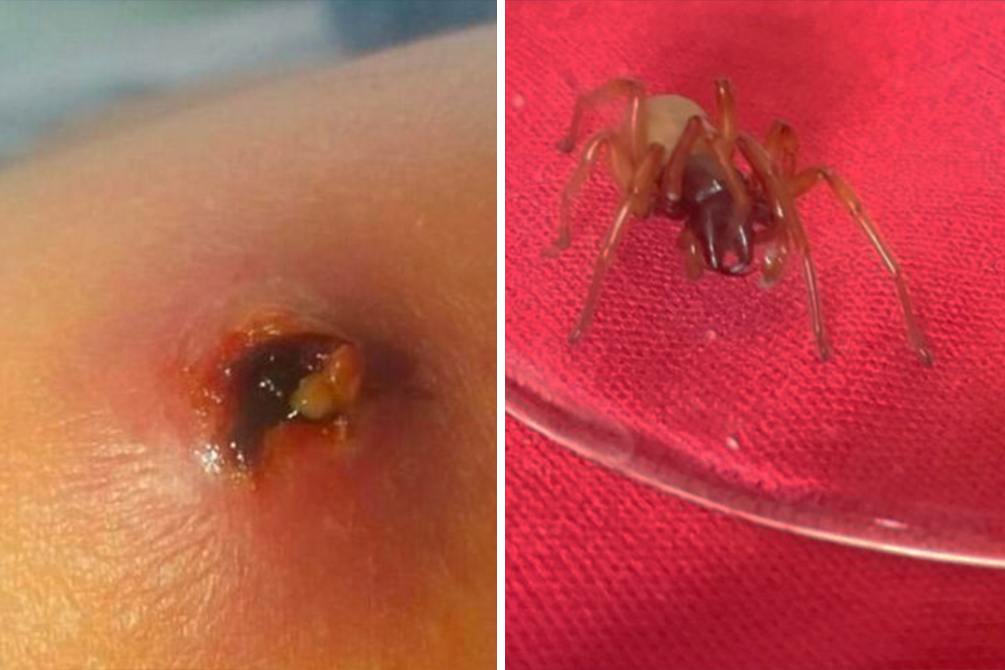 mae-picada-aranha-03